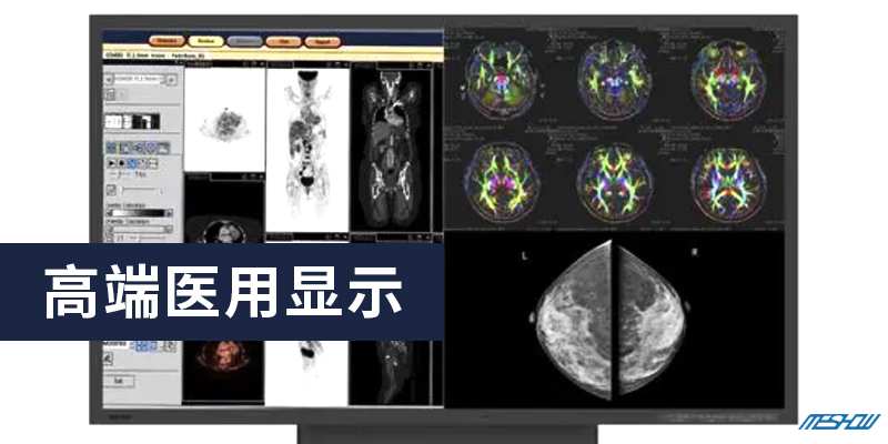800 400高端醫(yī)用顯示.jpg